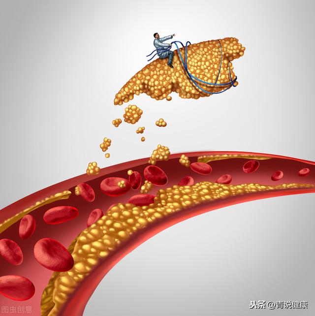 血栓和斑块有什么区别？纳豆激酶可以起到什么作用？